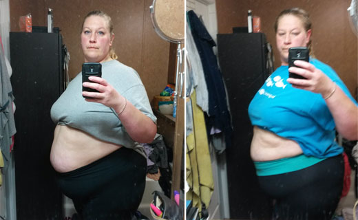 Atkins Weight Loss Timeline Gastric Sleeve